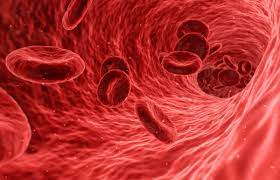 血管硬化-心血管疾病